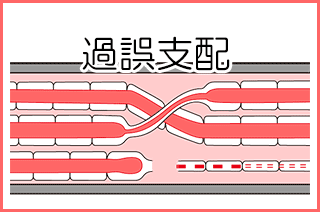 顔面神経麻痺:病的共同運動