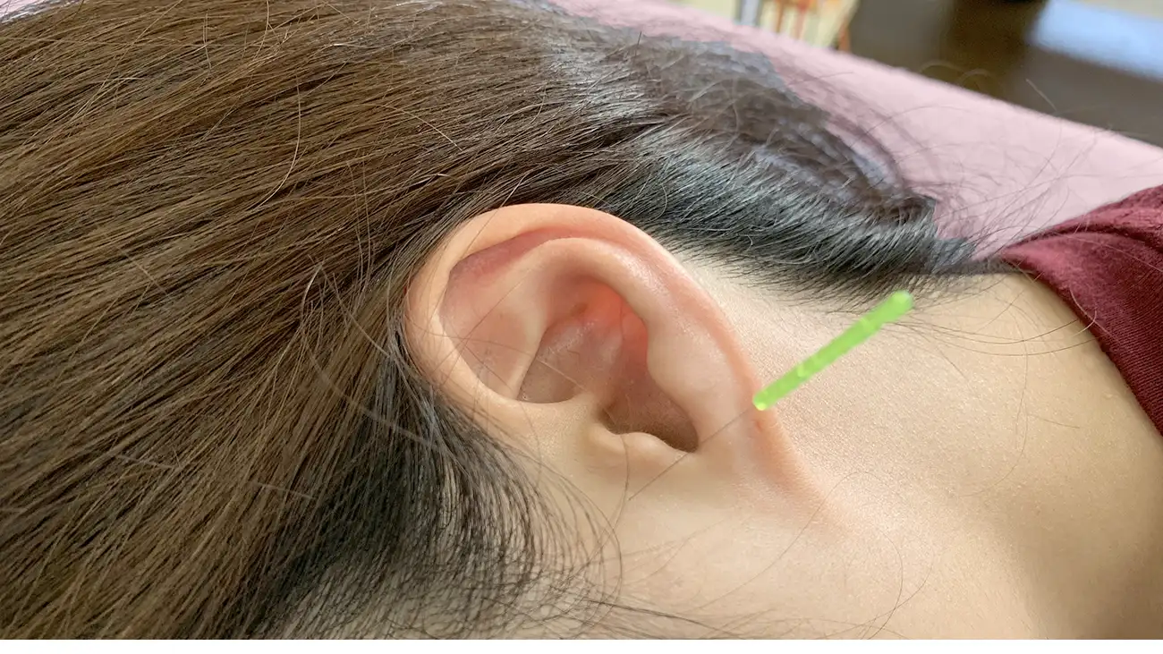 突発性難聴の治療