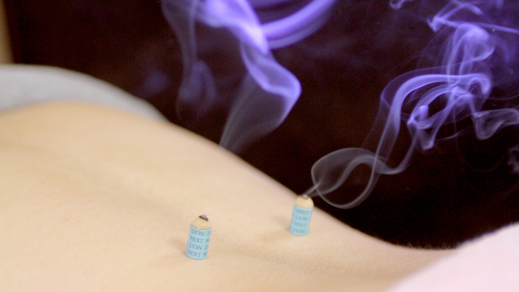 中野区冷え性外来