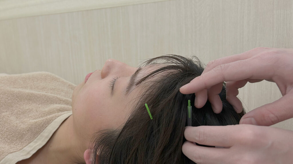 中野区歯ぎしり治療