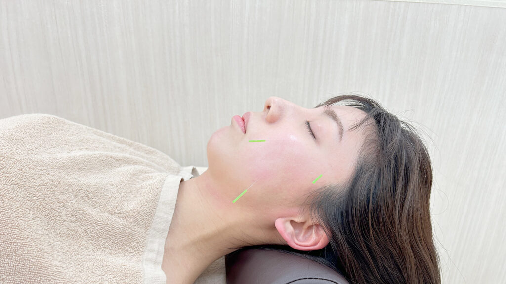 中野区女性の顎関節症